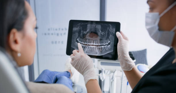 Licensed Tooth Extraction service in Sandy Springs, GA - Smile Center Dentistry